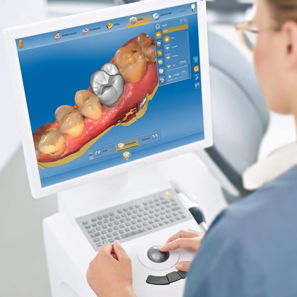 CEREC - Digitaler Zahnersatz in Köln