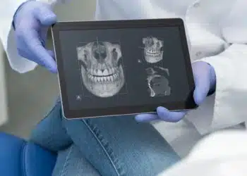 Digital X-ray - Digital Dental Practice in Cologne