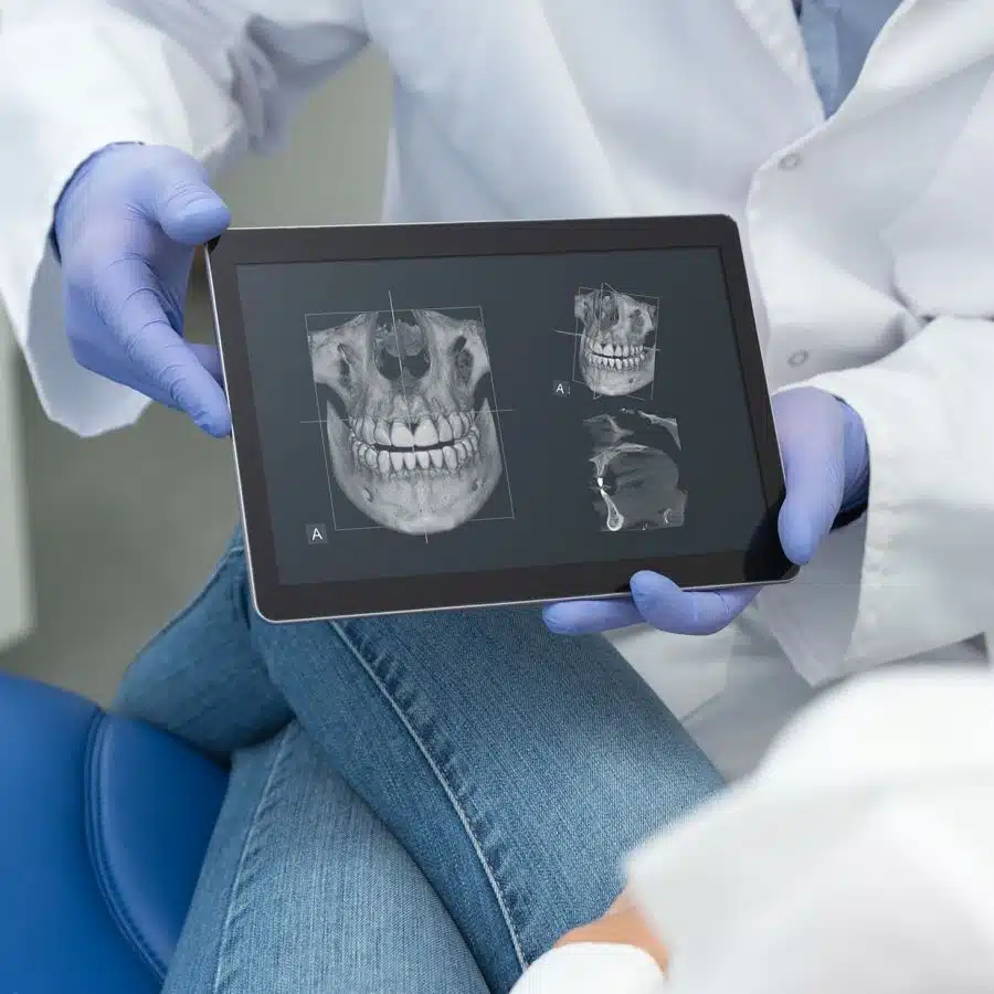 Digital X-ray - Digital Dental Practice in Cologne